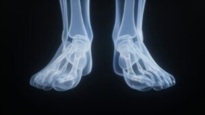 Cartiva lawsuit: x-ray image of human feet against a black background