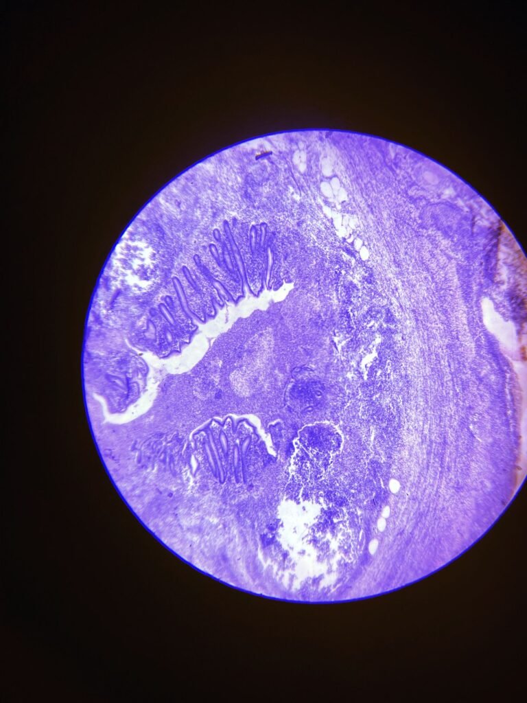CTCL vs eczema: microscope view of a blue-stained tissue sample, similar to a skin biopsy slide