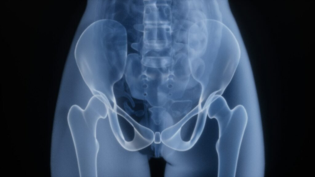 Cartiva settlement: blue-toned x-ray style illustration of a human pelvis and hip joints
