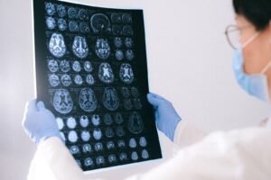 Depo-Provera brain tumor claims: hands holding brain MRI films up for review in a clinic