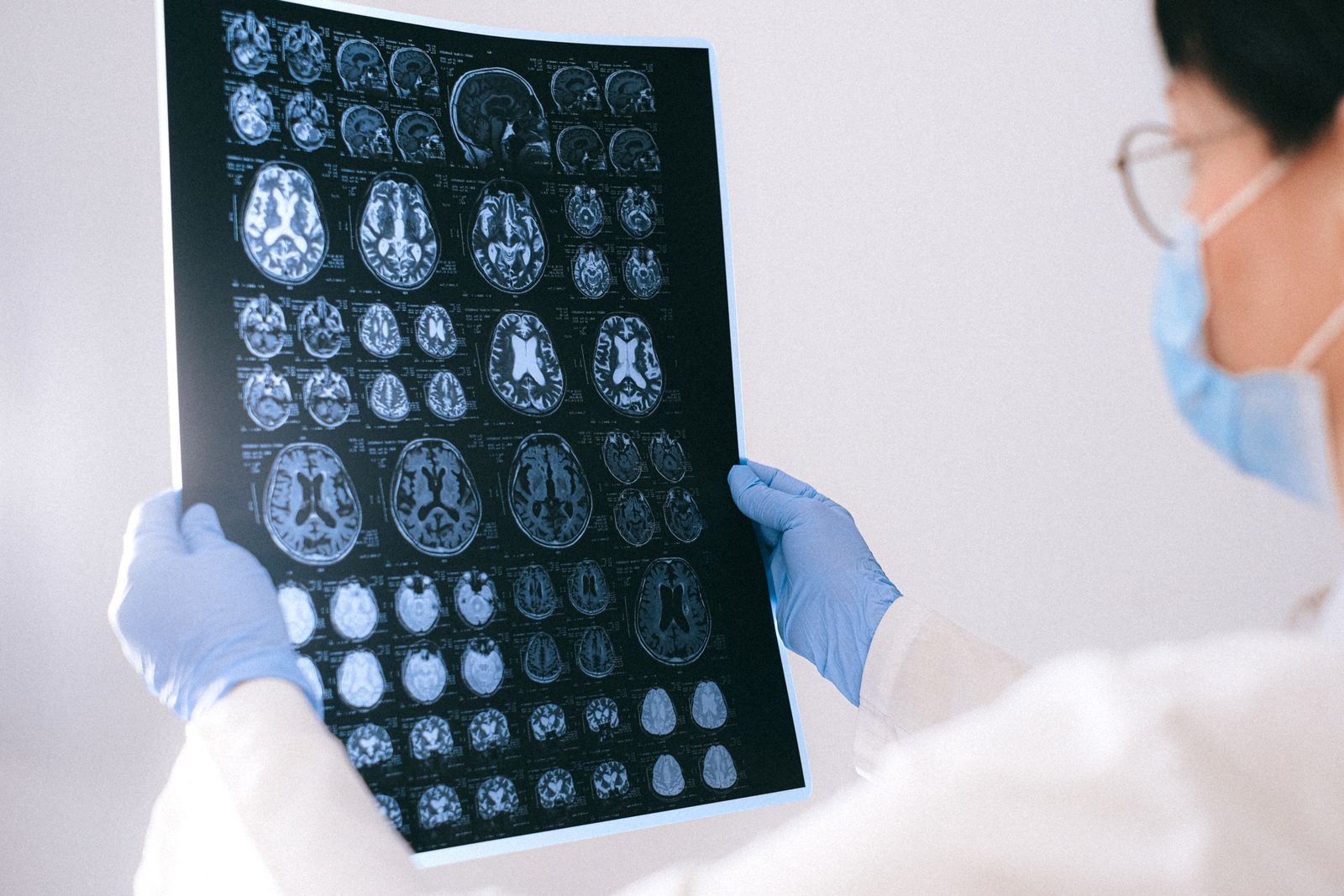 Hands holding brain MRI films up for review in a clinic