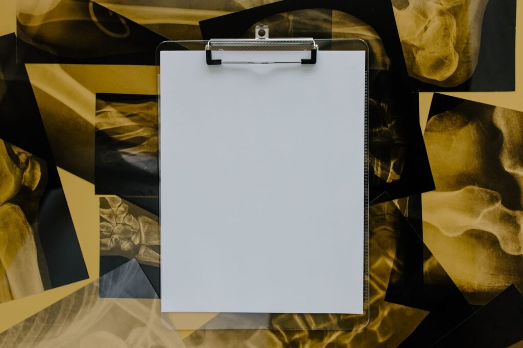 Mesothelioma evidence standards: blank clipboard lying on top of several x-ray films