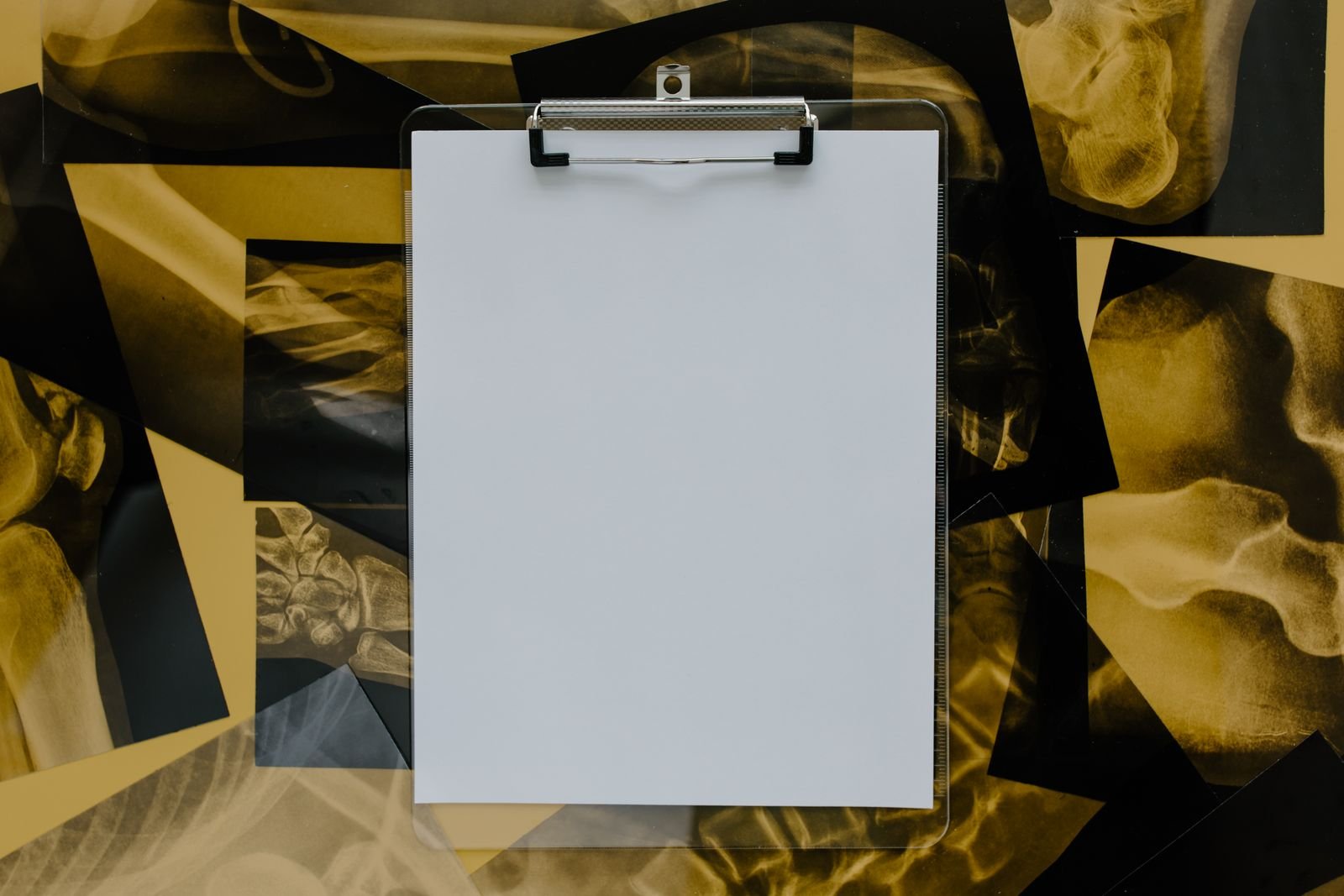 Mesothelioma evidence standards: blank clipboard lying on top of several x-ray films