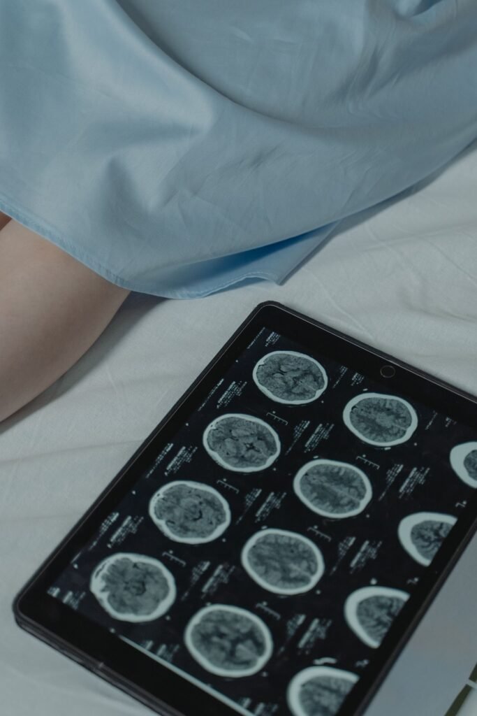 Depo-Provera meningioma symptoms: brain scan images displayed on a tablet in a hospital setting
