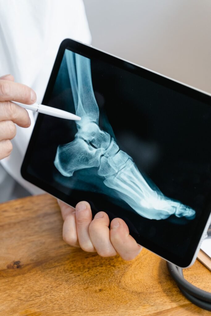 Cartiva implant claims: hands pointing a stylus at a foot x-ray on a tablet