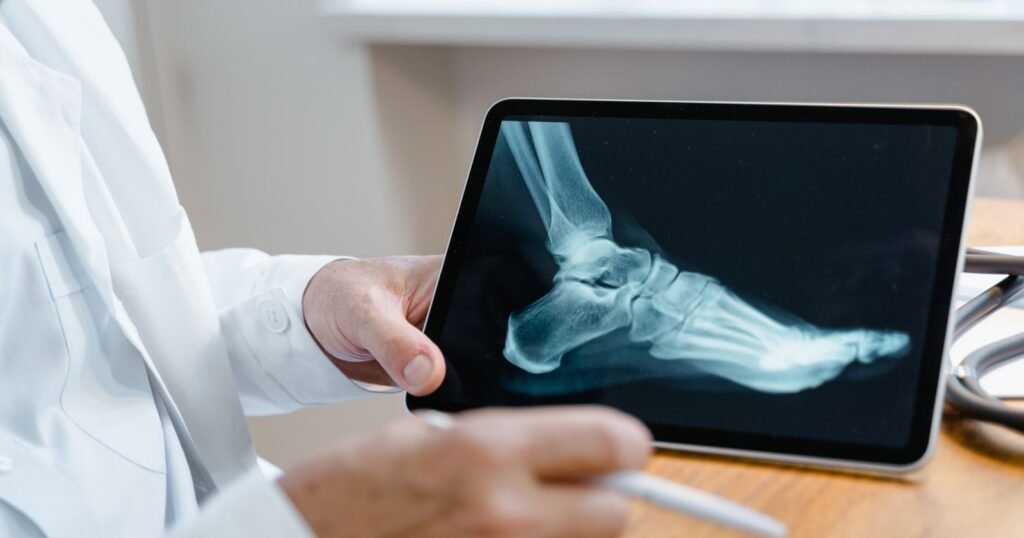Doctor reviewing a foot X-ray after Cartiva toe implant surgery