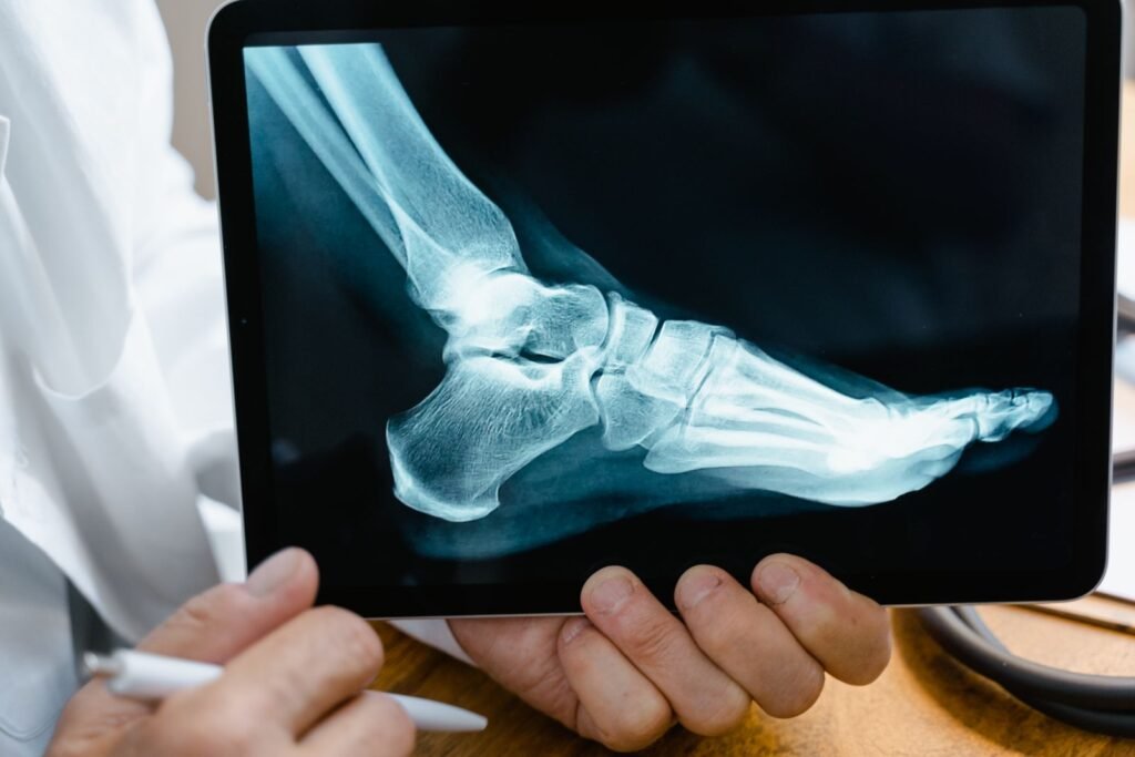 Doctor reviewing a foot X-ray on a tablet while planning Cartiva revision surgery