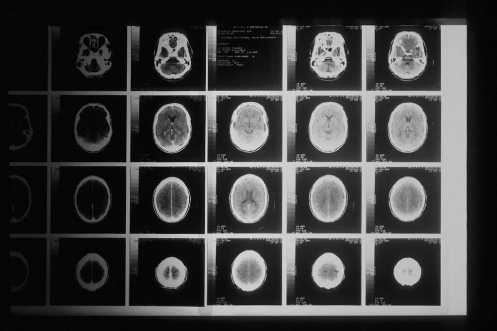 Black and white head scan images laid out in a grid, showing brain imaging slices