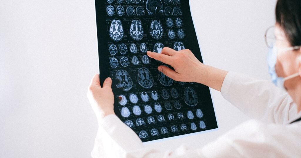 Doctor examining brain MRI scans for a meningioma linked to Depo-Provera