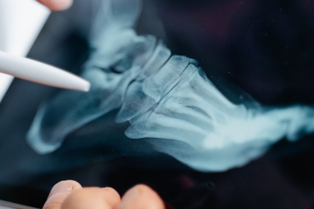Foot X-ray on a digital tablet, the kind of imaging record reviewed before any Cartiva settlement