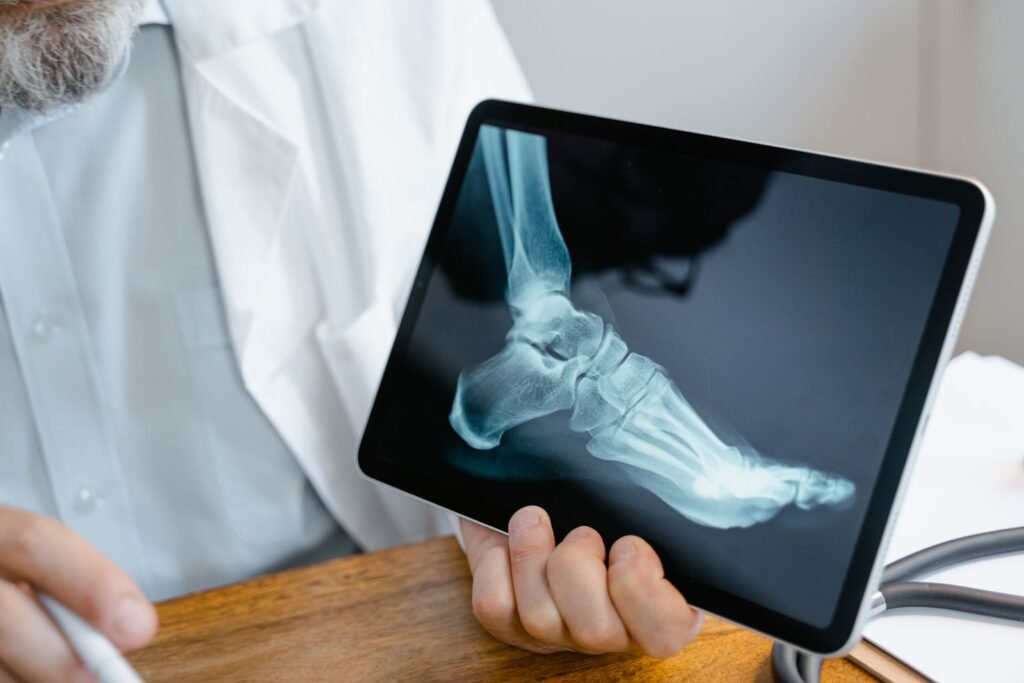 Doctor reviewing a foot X-ray on a tablet, a common first step when Cartiva implant failure is suspected